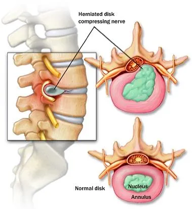 ORTHOPAEDICS, ACCIDENT, TRAUMA, BACK, NECK ,BONE AND JOINT. image 1